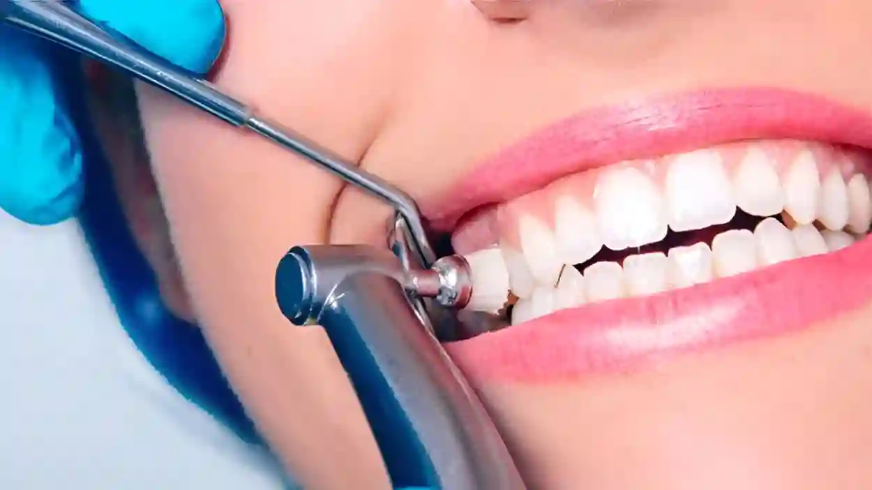تحذير استشاري من تقويم الأسنان