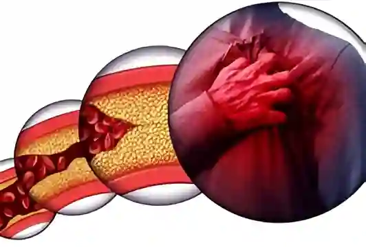 8 عادات صباحية تضر بقلبك